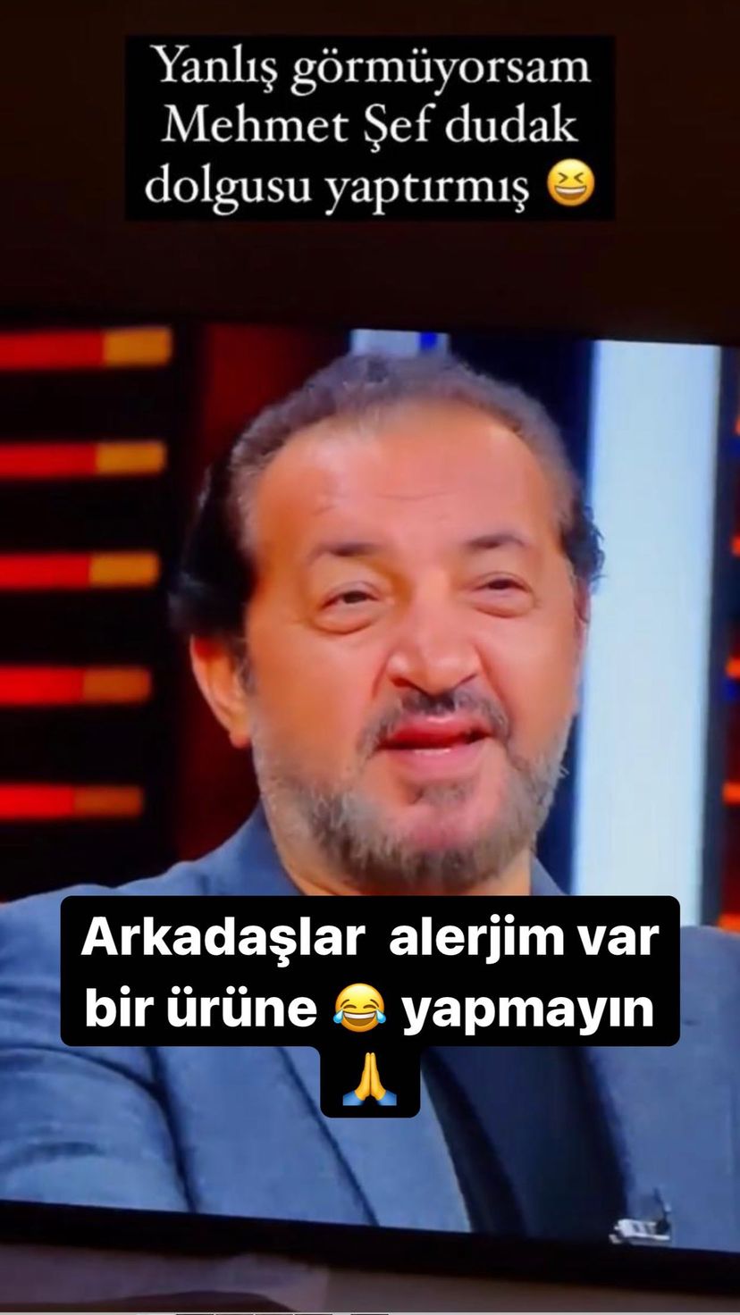 Ünlü şef Mehmet Yalçınkaya’dan dudak dolgusu yaptırdığı iddialarına yanıt