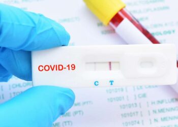 Covid-19 testi