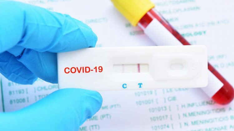 Covid-19 testi