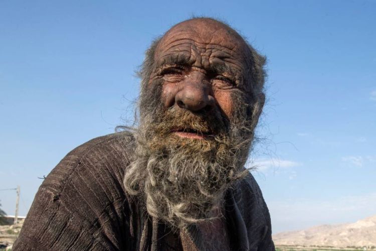 Hastalanma korkusuyla 60 yıldır yıkanmayan adam ilk banyosundan sonra öldü!
