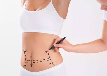 Bir bilene sorduk: Mini karın germe nedir?