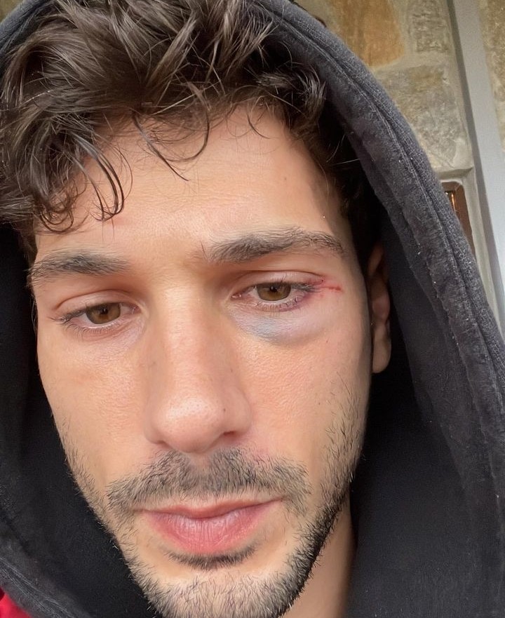Deniz Can Aktaş’ın başına gelen talihsiz olay hayranlarını üzdü