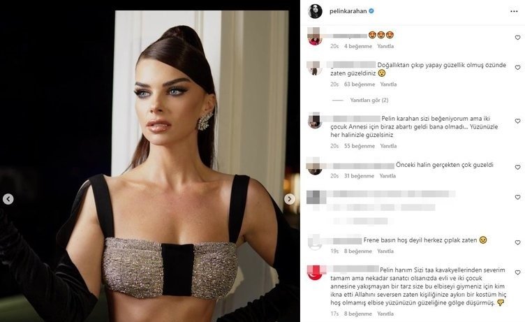 Estetik yaptıran Pelin Karahan'a takipçilerinden tepki yağdı!