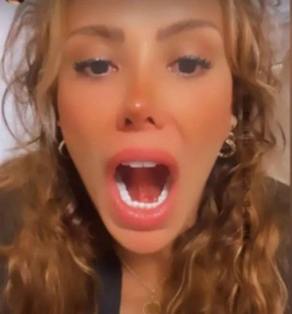 Ciciş Kardeşlerden Esra'nın öpüşürken dili koptu!