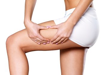 Selülit nedir? Vücutta oluşan selülit nasıl geçer?