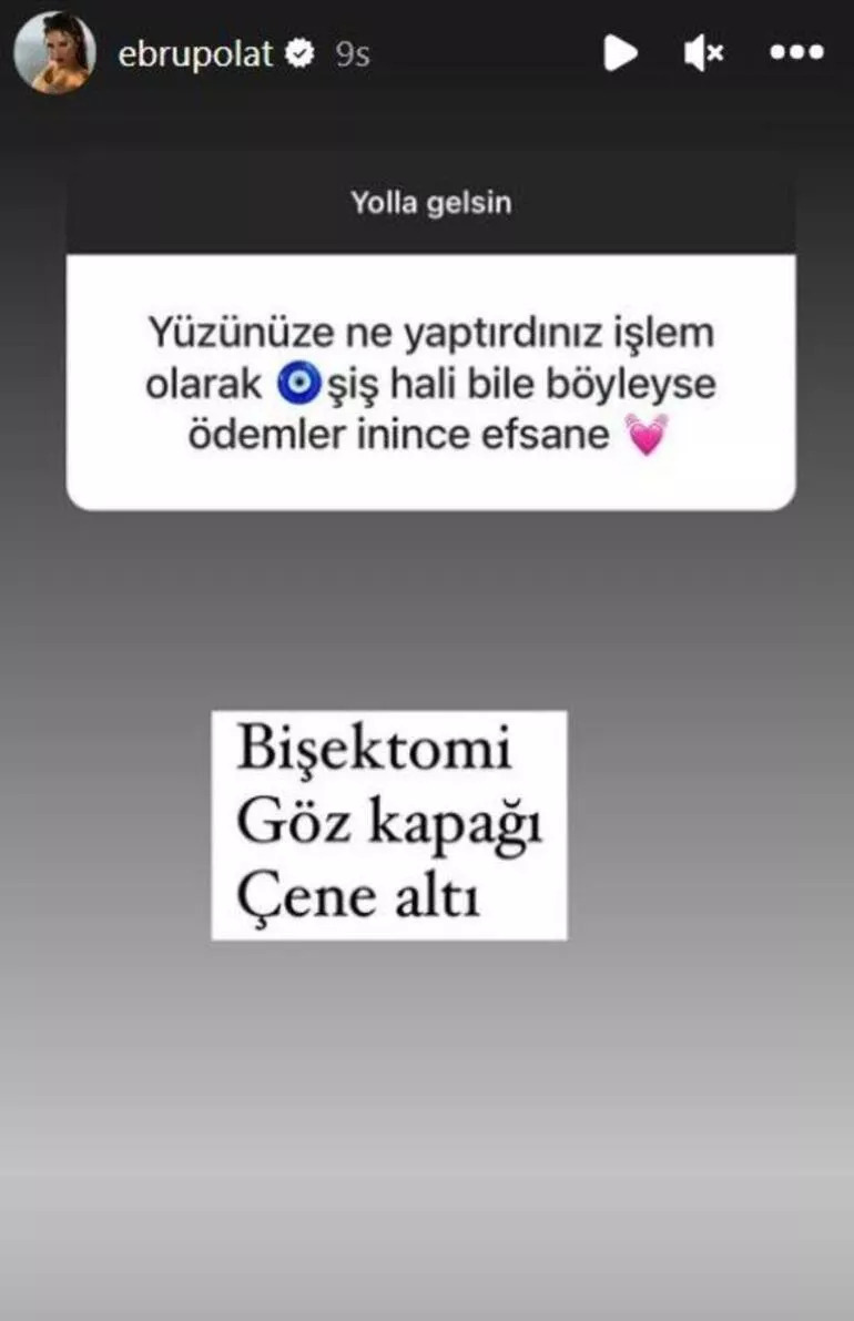 Ebru Polat estetiklerini saydı