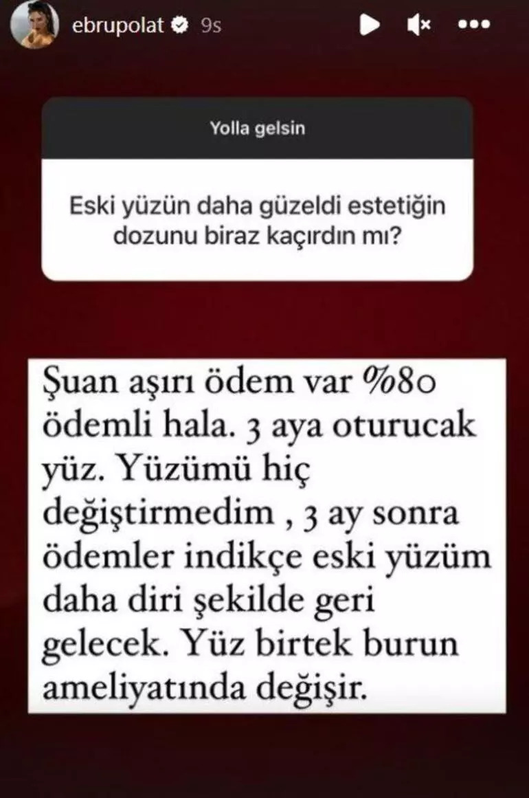 Ebru Polat estetiklerini saydı