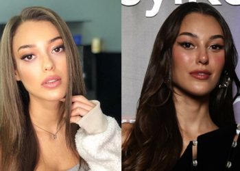 Estetik yaptıran Dilan Çiçek Deniz işinden oldu!